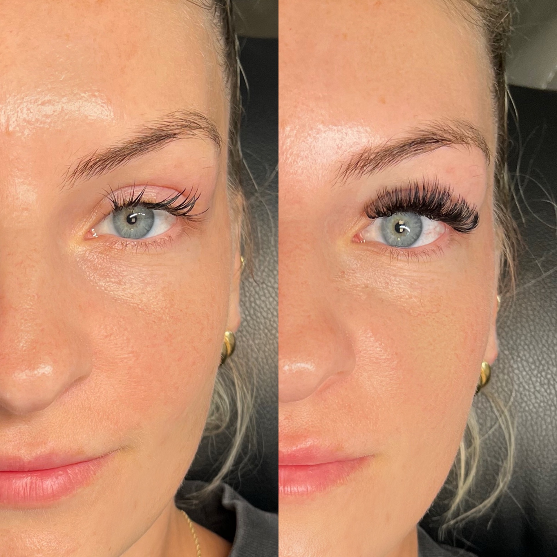 About face essentials, Acne Treatment in Lincoln Park, NJ - photo 1