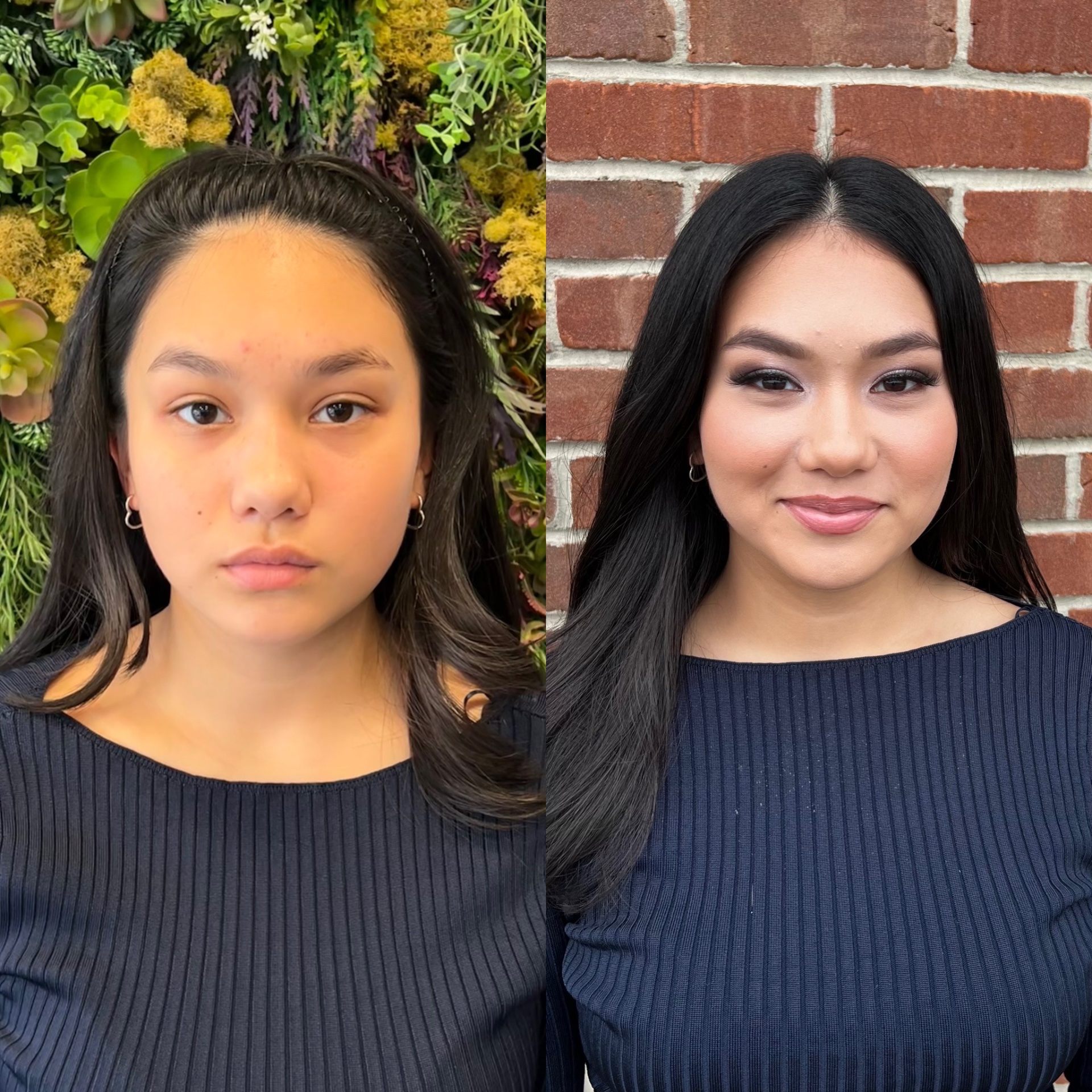 About face essentials, Acne Treatment in Lincoln Park, NJ - photo 2