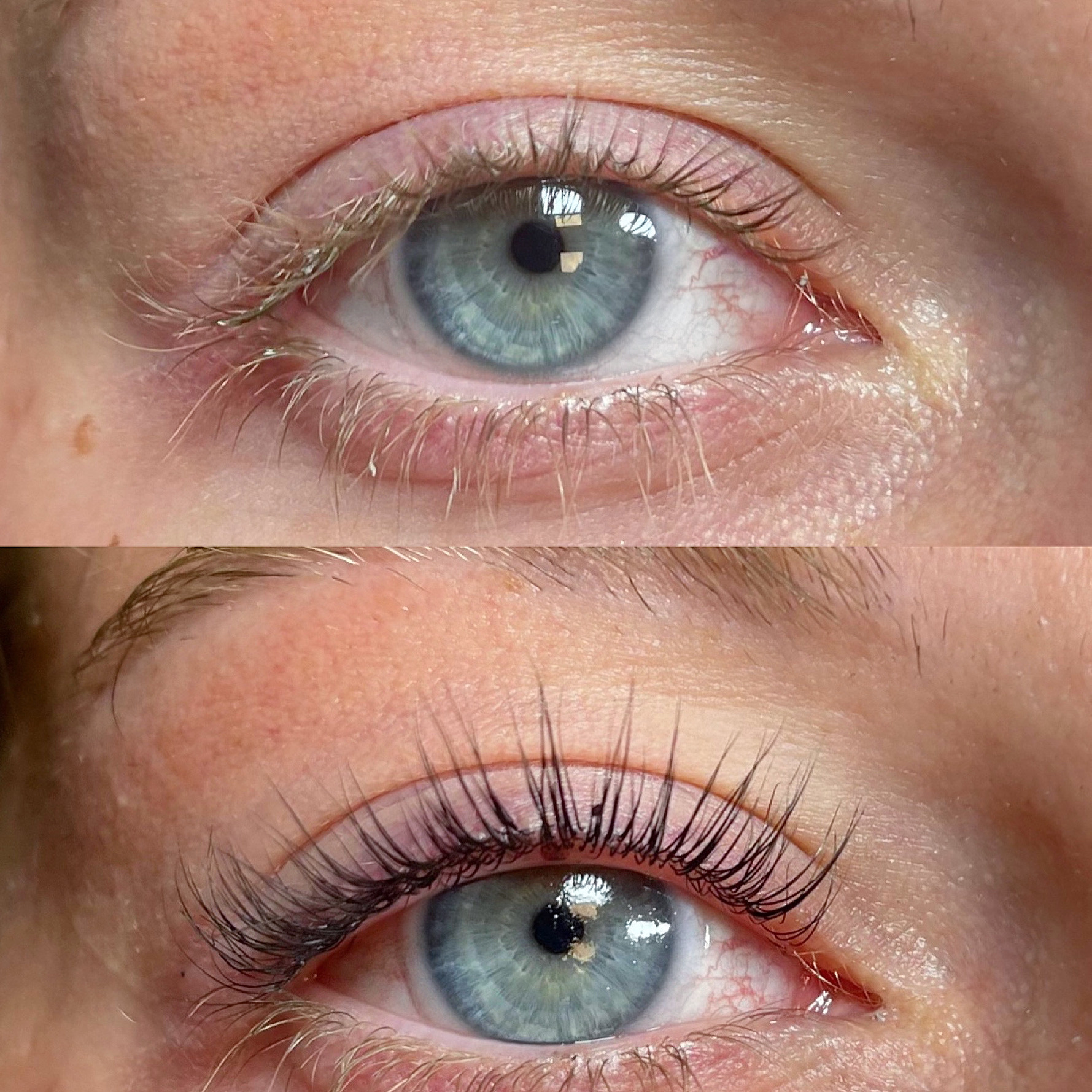 About face essentials, Acne Treatment in Lincoln Park, NJ - photo 3