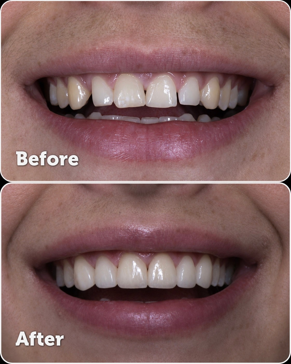 PG Dental Spa, Aestheticians in Cliffside Park, NJ - photo 3