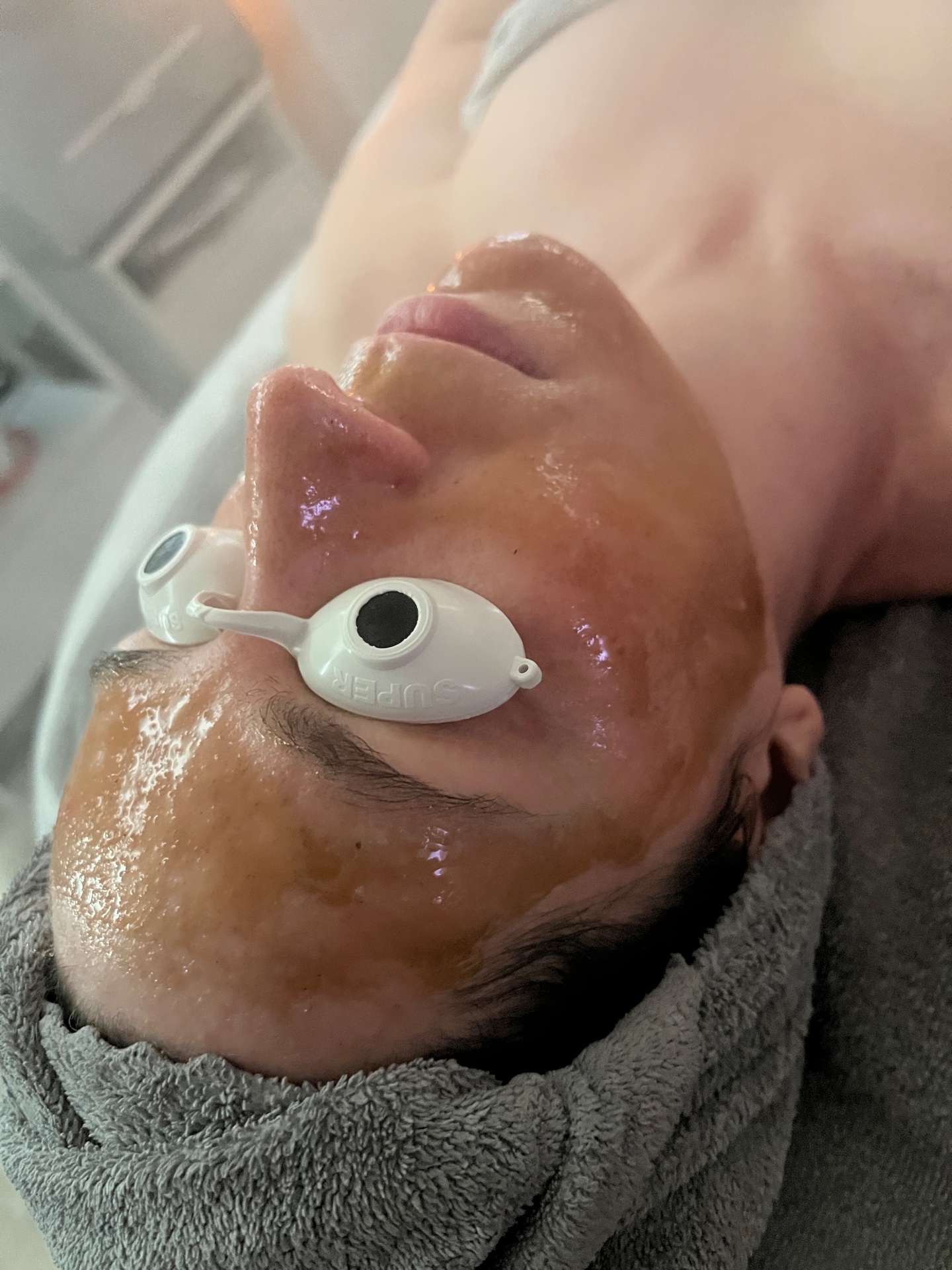The Skin Co., Acne Treatment in Orange, CA - photo 3