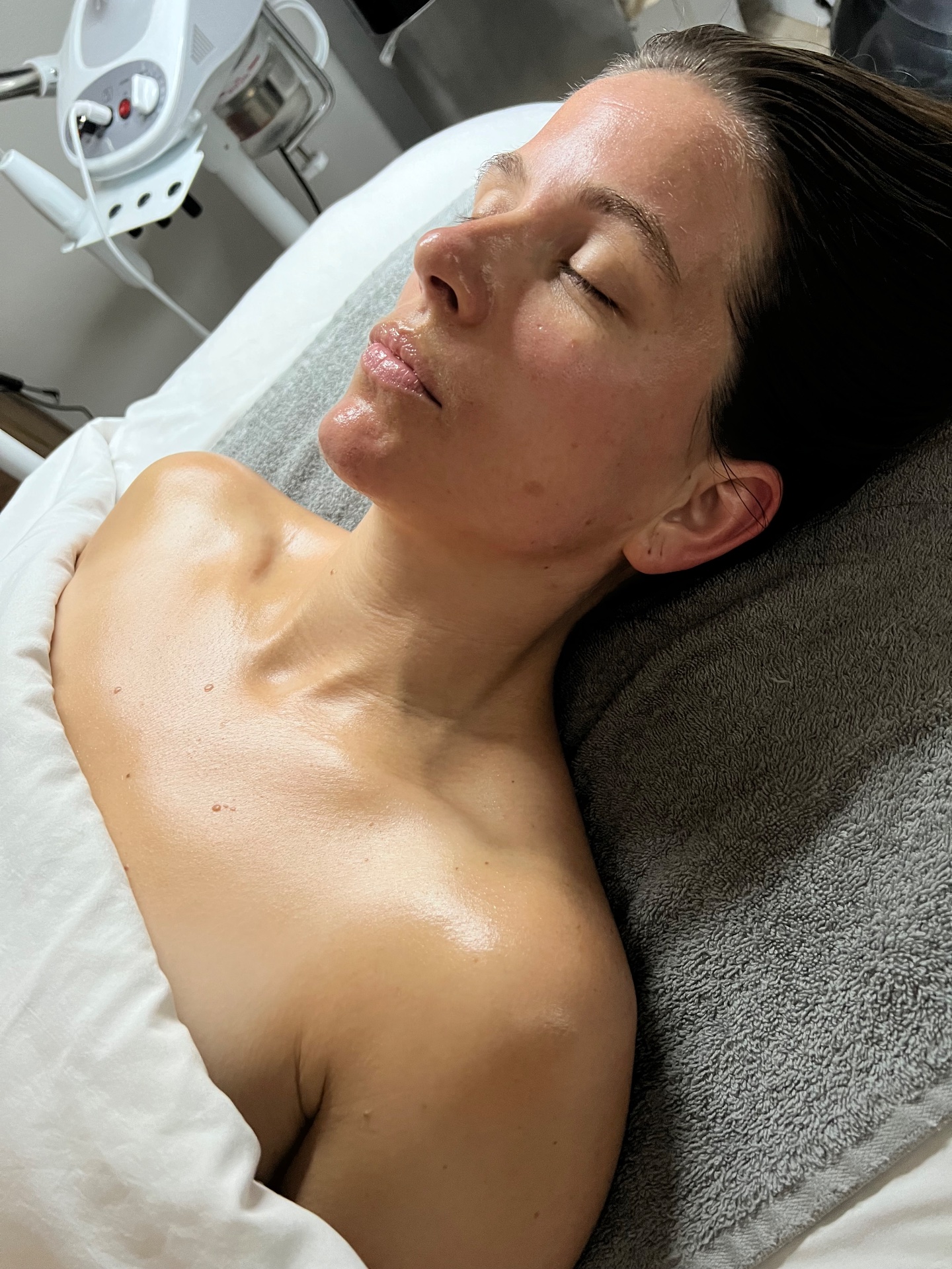 The Skin Co., Acne Treatment in Orange, CA - photo 5