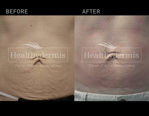 Healthydermis MedSpa, Aestheticians in Gainesville, VA - photo 2