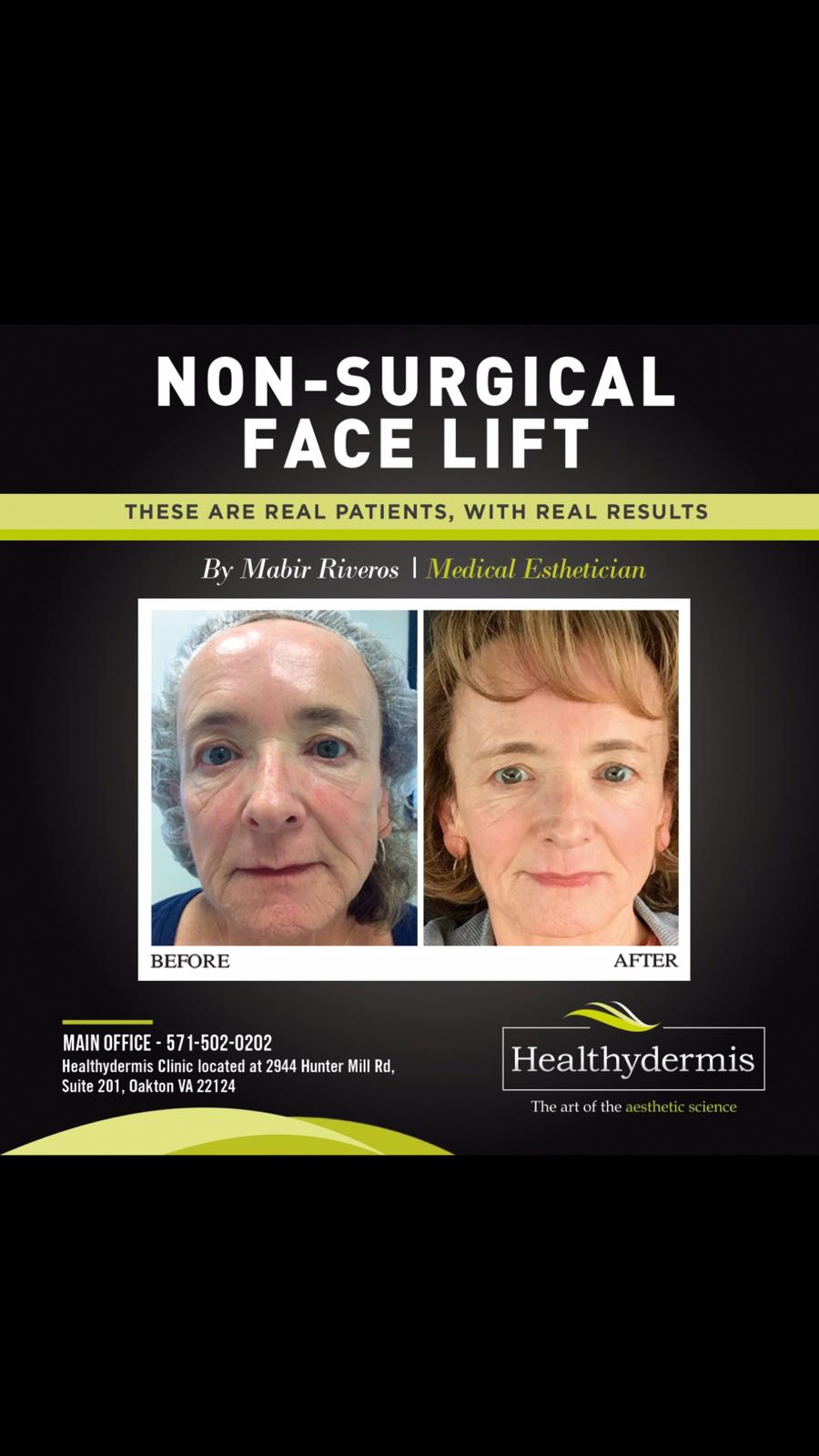 Healthydermis MedSpa, Aestheticians in Gainesville, VA - photo 4