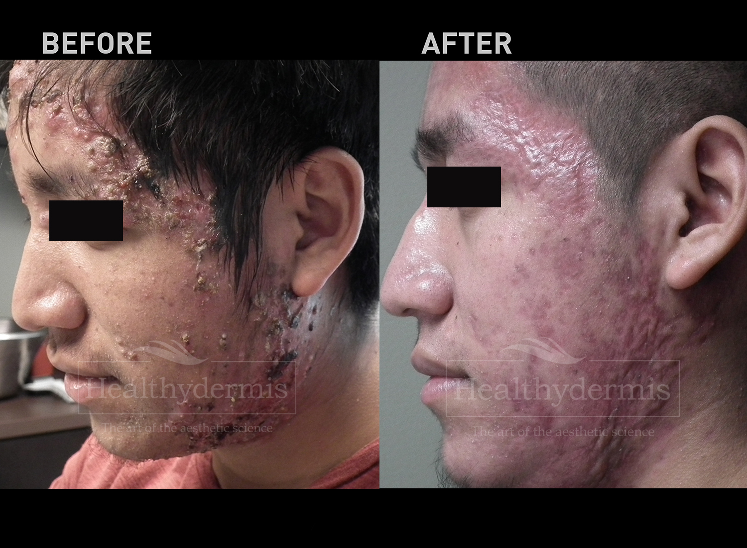 Healthydermis MedSpa, Aestheticians in Gainesville, VA - photo 6