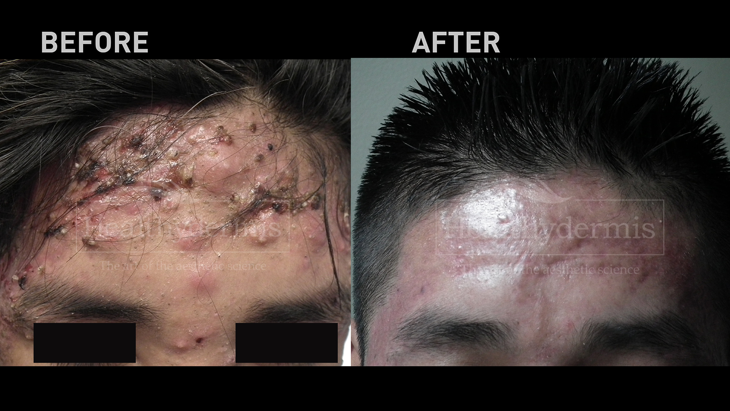 Healthydermis MedSpa, Aestheticians in Gainesville, VA - photo 7