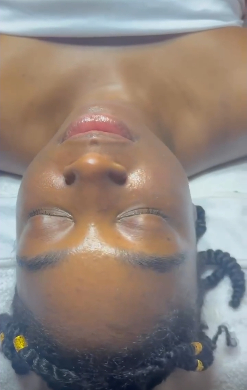 Yeshua Spa & Wellness Center, Acne Treatment in East Windsor, CT - photo 4