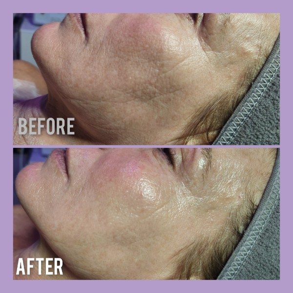 Sophiesticated Esthetics, Acne Treatment in Miami, FL - photo 2