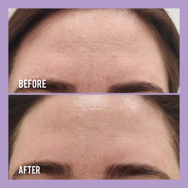 Sophiesticated Esthetics, Acne Treatment in Miami, FL - photo 3