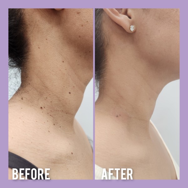 Sophiesticated Esthetics, Acne Treatment in Miami, FL - photo 5