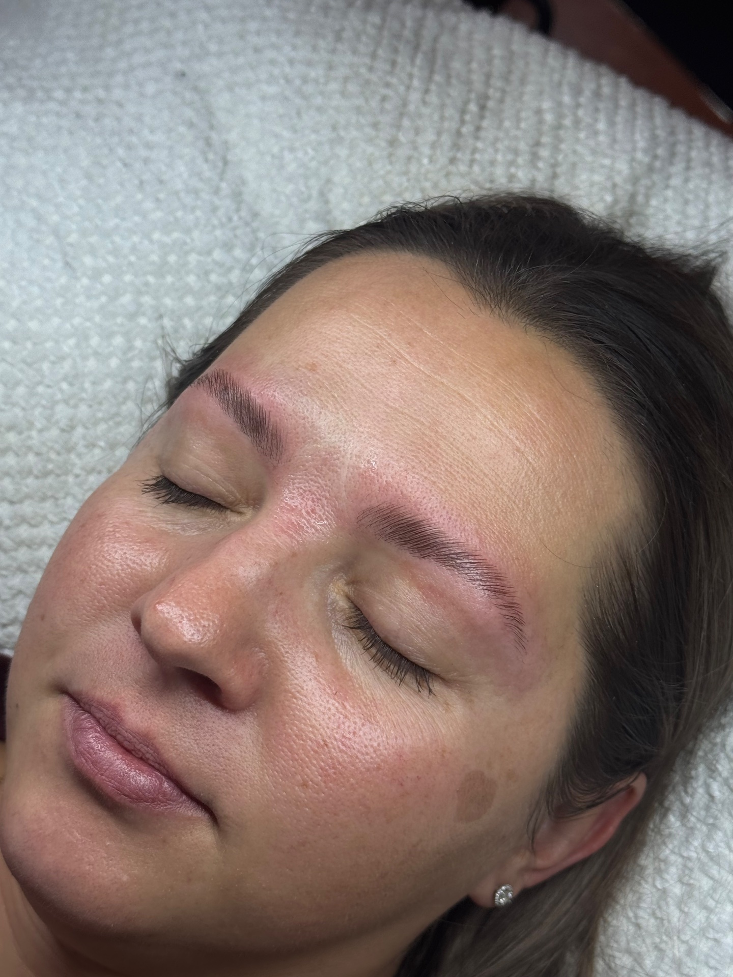 Skye Esthetics, Acne Treatment in Nesconset, NY - photo 4