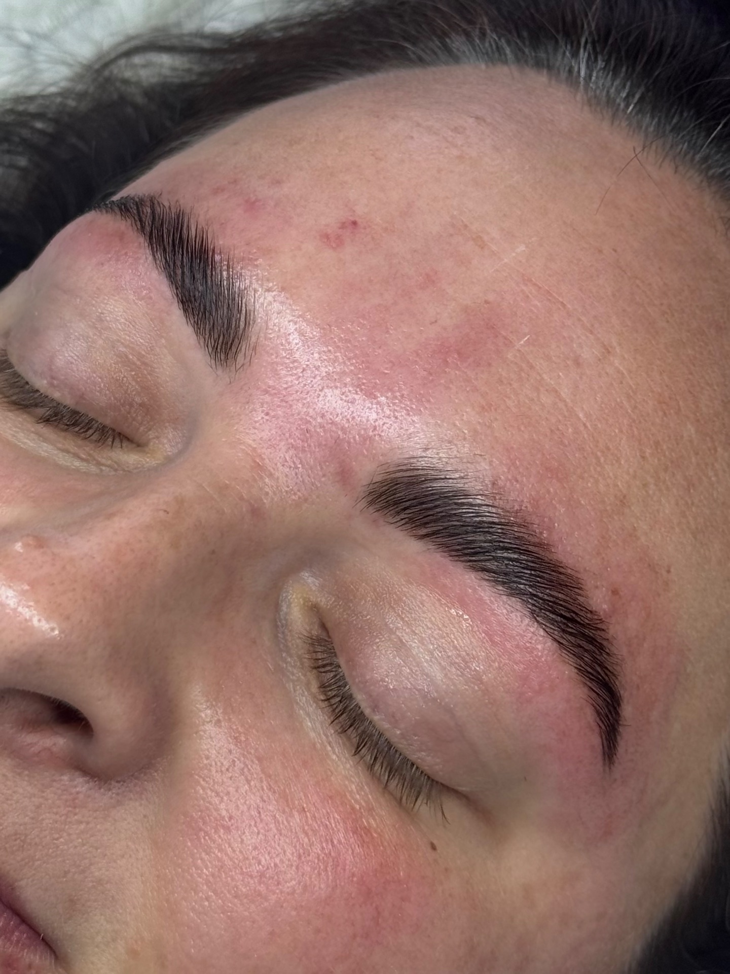 Skye Esthetics, Acne Treatment in Nesconset, NY - photo 7