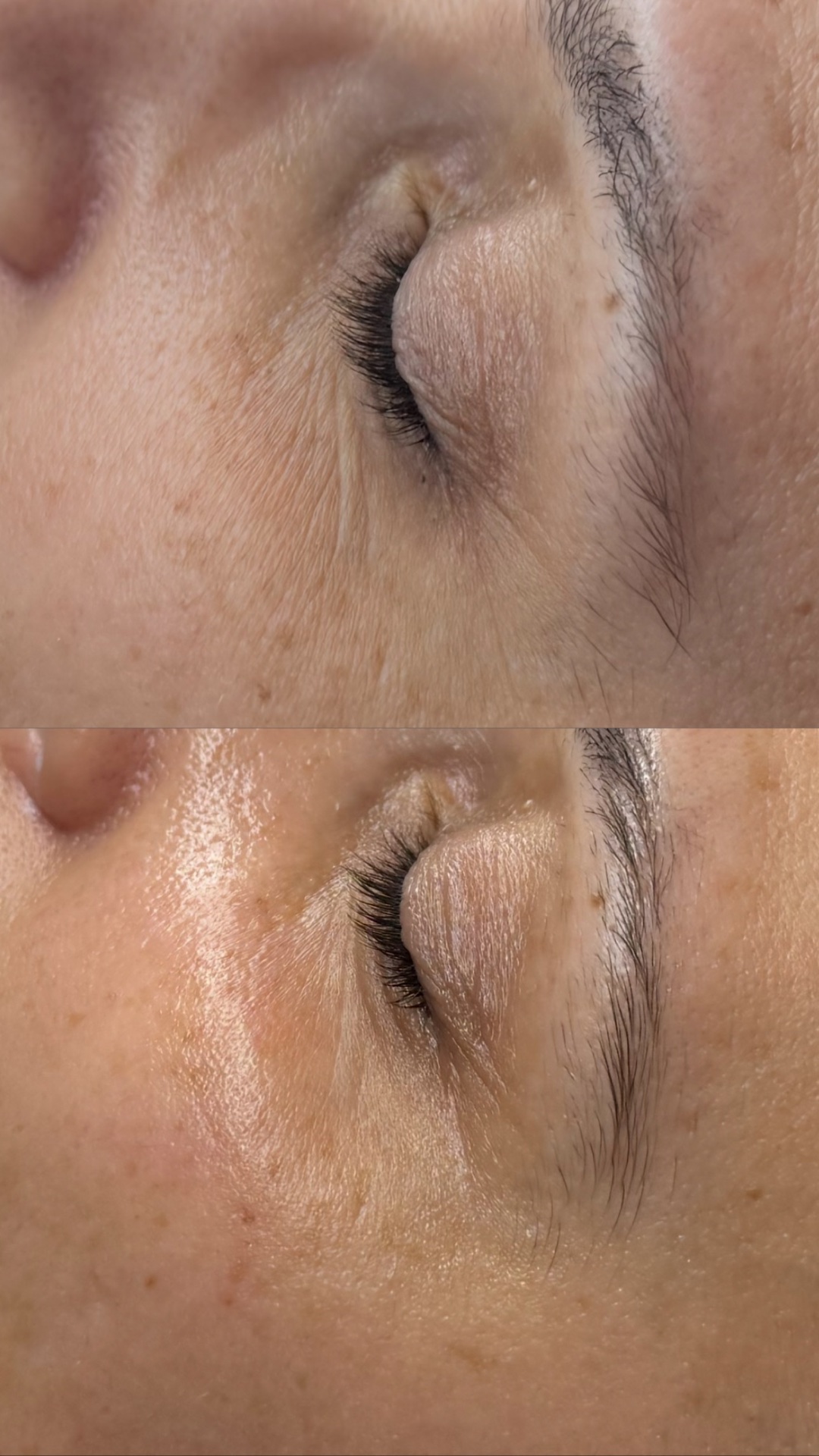 Skye Esthetics, Acne Treatment in Nesconset, NY - photo 8