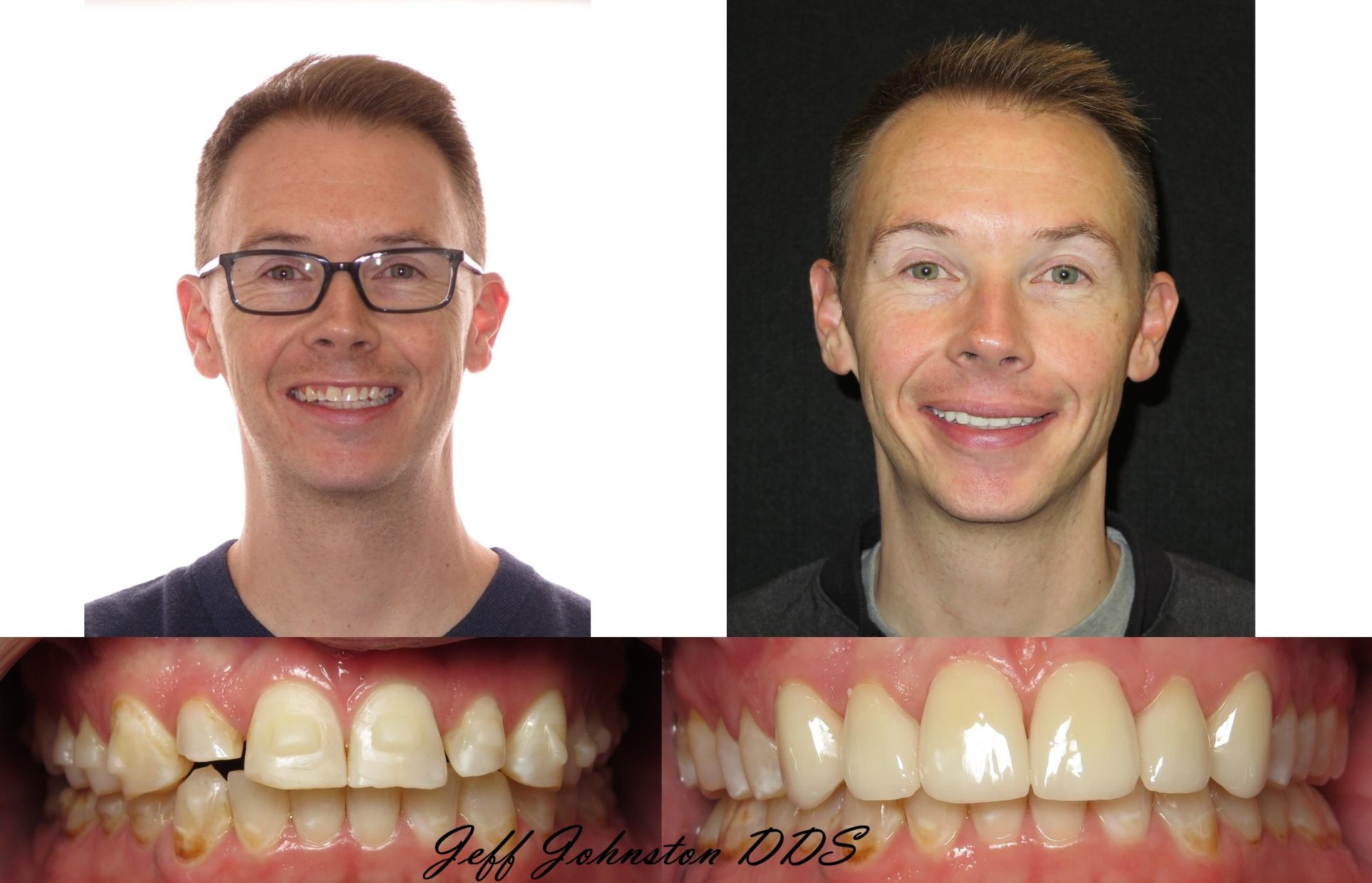 Ascent Dental Group, Cosmetic Dentists in Glendale, CO - photo 4