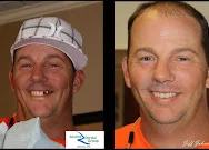 Ascent Dental Group, Cosmetic Dentists in Glendale, CO - photo 3