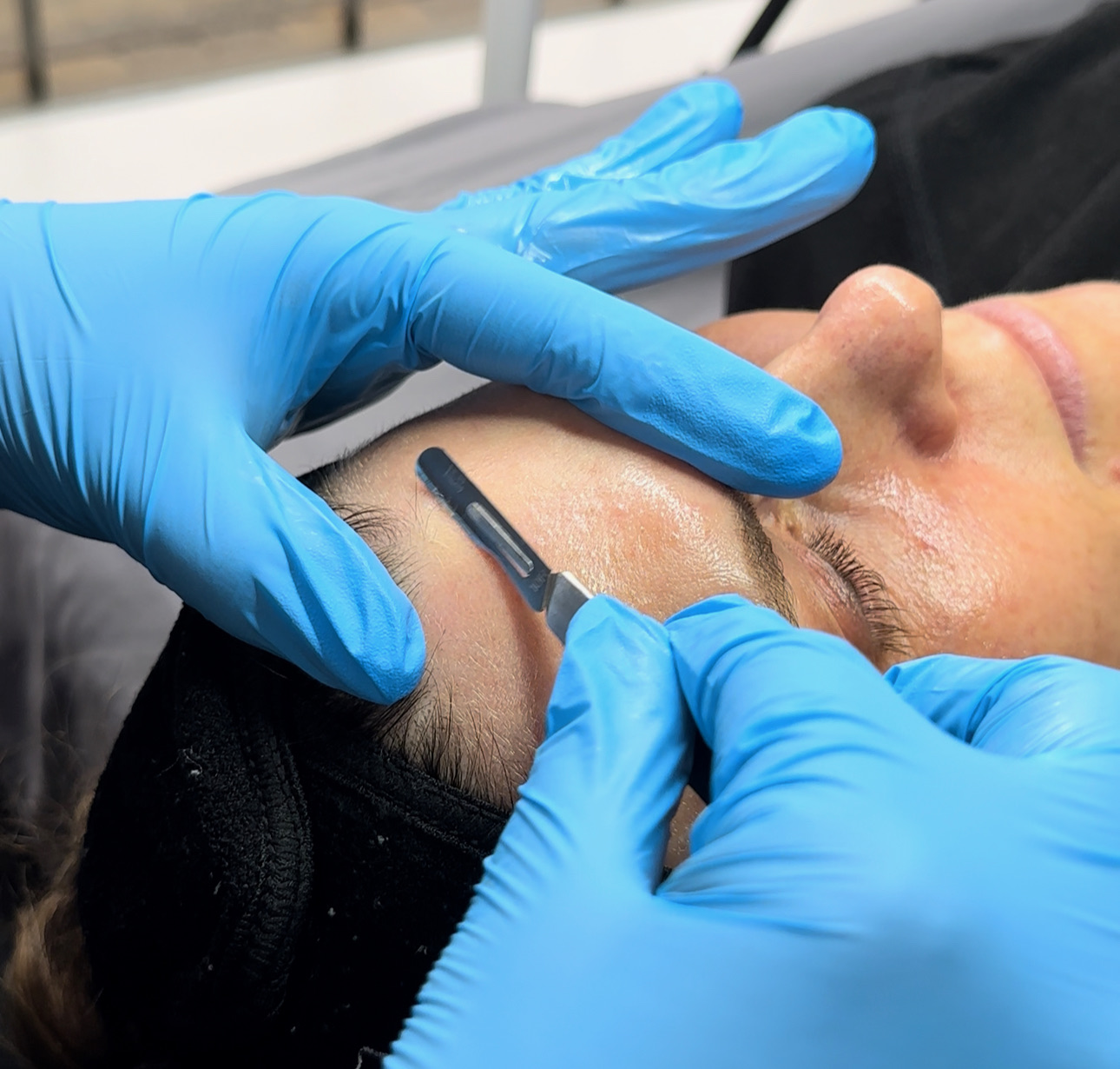 The Med Spa of Kingwood, Acne Treatment in Kingwood, TX - photo 2
