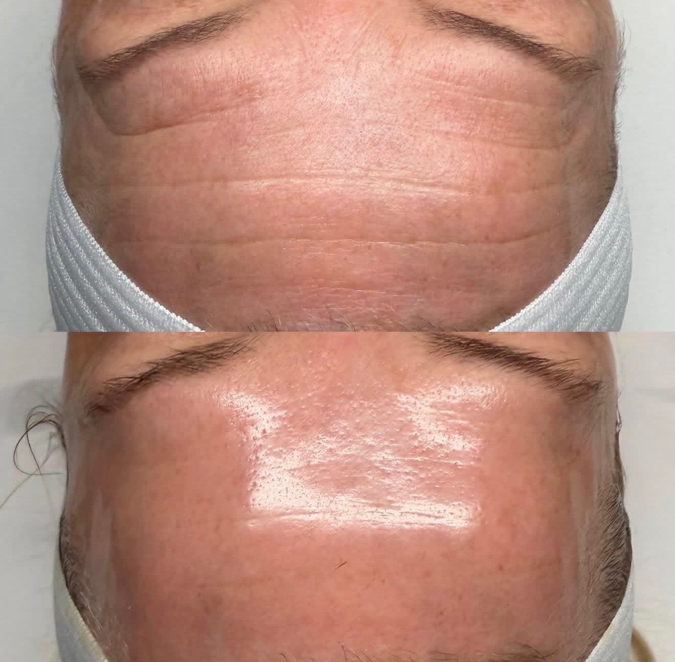 Premier Aesthetics, Acne Treatment in Las Vegas, NV - photo 6