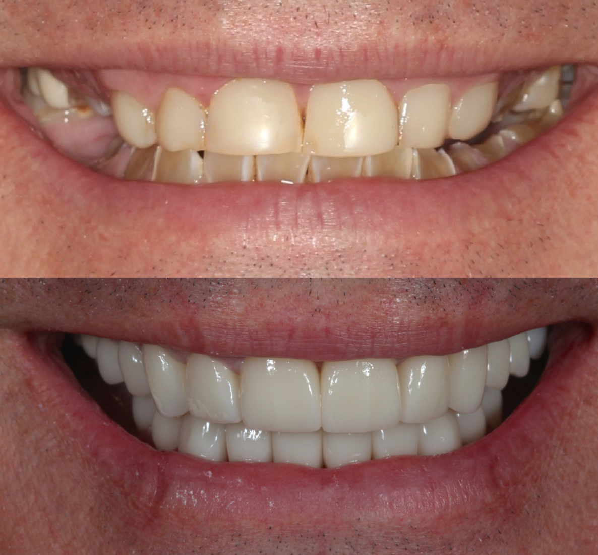Advanced Dentistry of Mount Pleasant, Cosmetic Dentists in Mount Pleasant, SC - photo 5