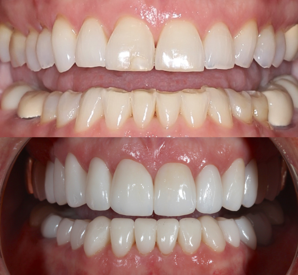 Advanced Dentistry of Mount Pleasant, Cosmetic Dentists in Mount Pleasant, SC - photo 6