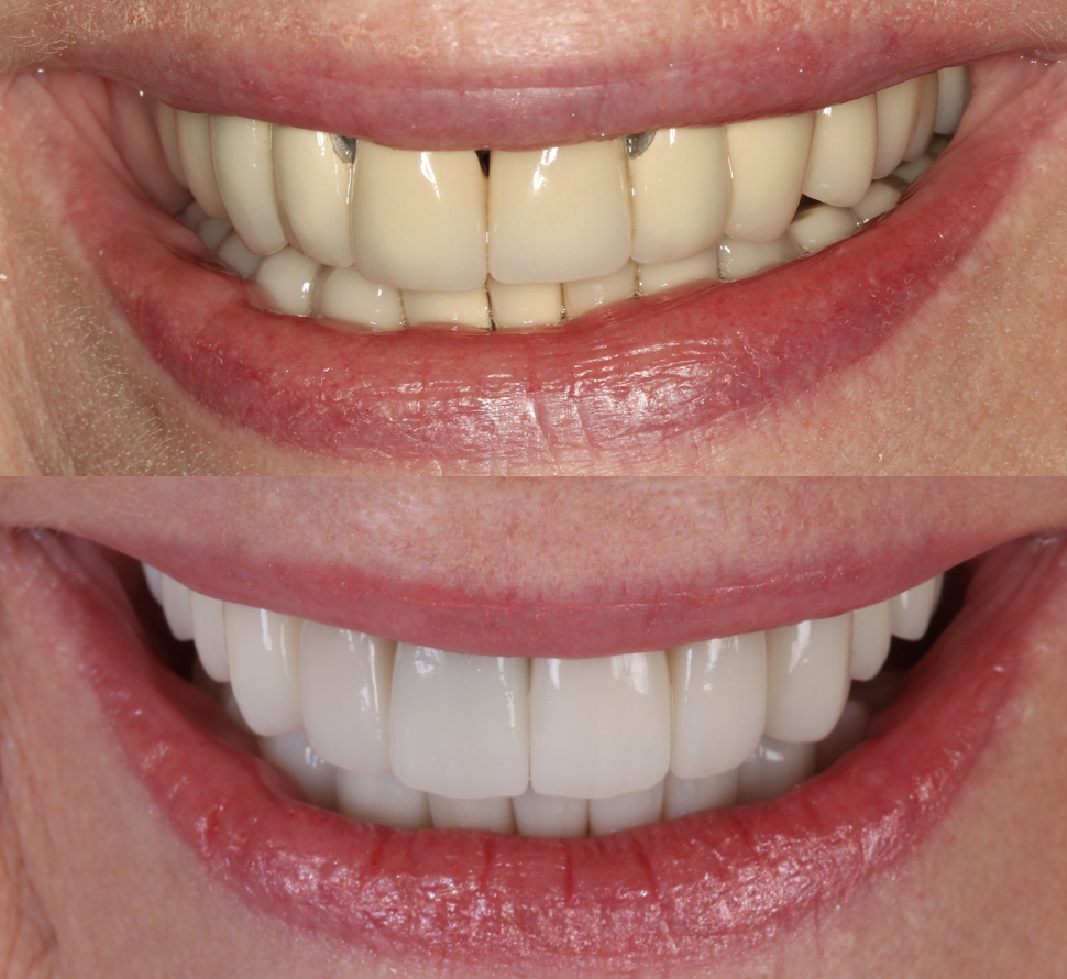 Advanced Dentistry of Mount Pleasant, Cosmetic Dentists in Mount Pleasant, SC - photo 7